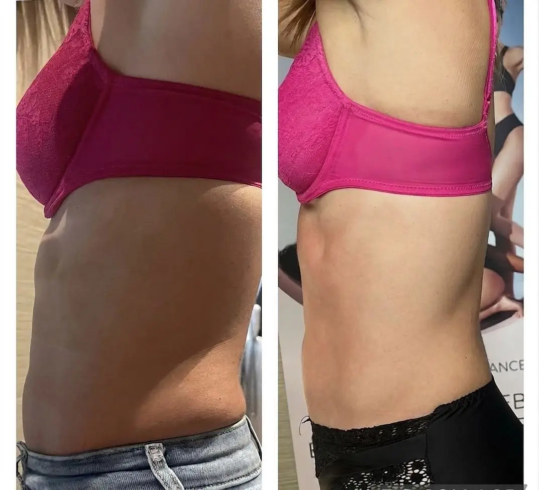 Voor en na resultaat van Annelies, 38